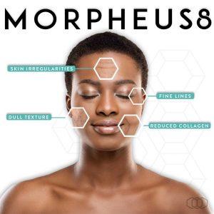 Morpheus 8 la meilleure machine de sa catégorie en radiofréquence à Nîmes