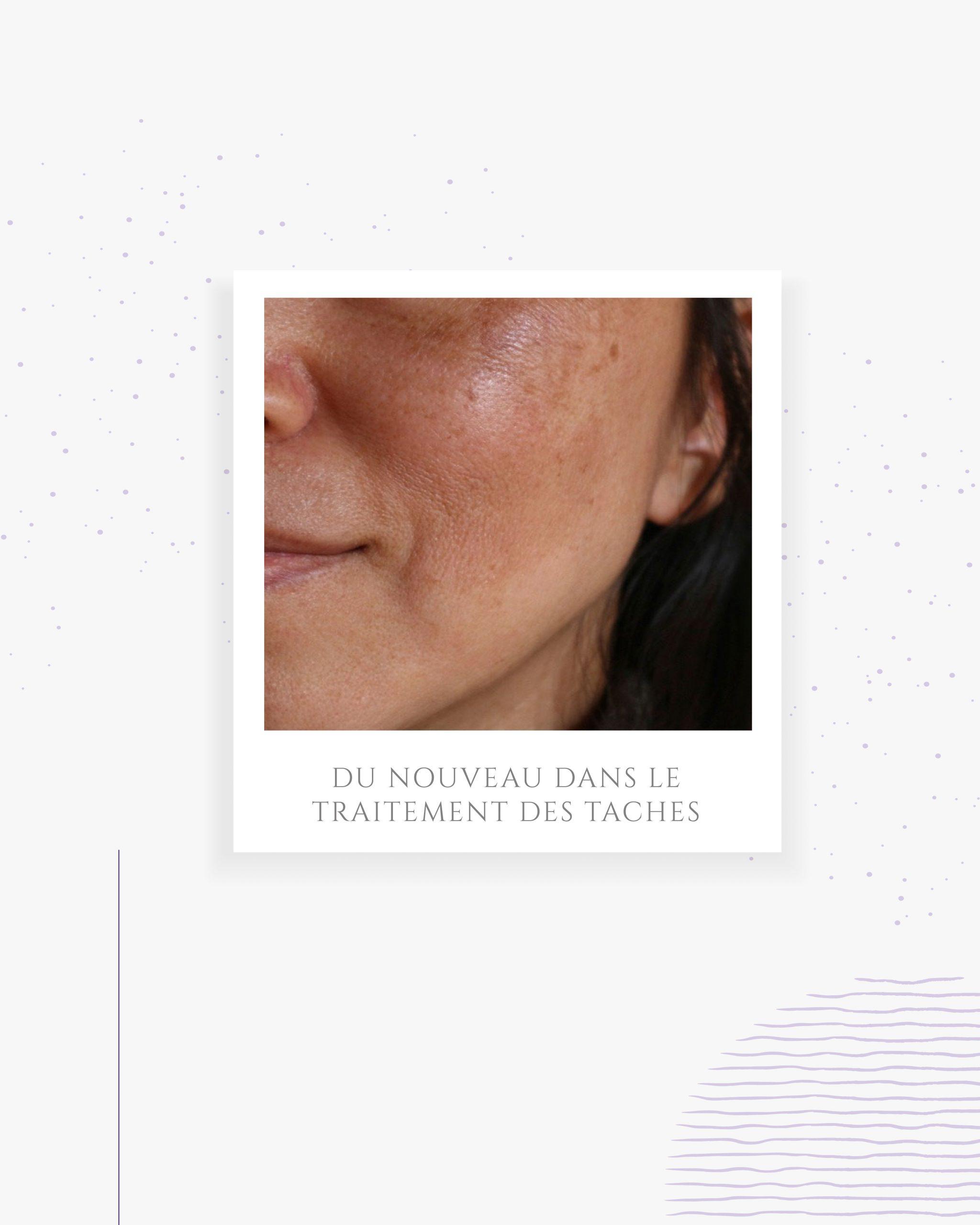 Du nouveau dans le traitement des tâches