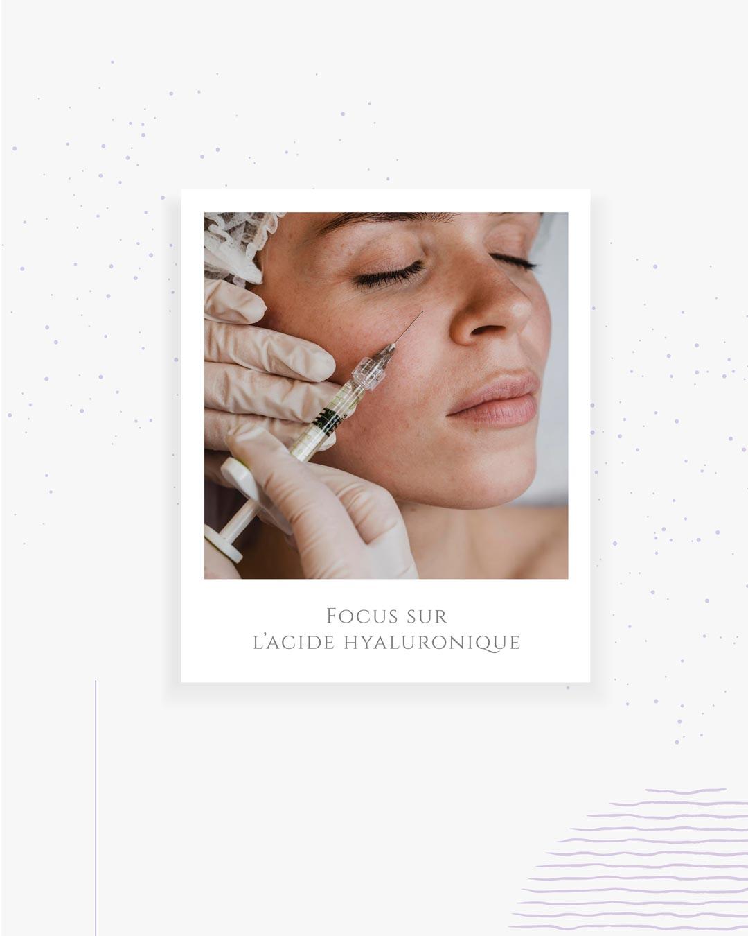 En médecine esthétique, on utilise l’acide hyaluronique sous forme de gel pour hydrater, combler les rides, restaurer les volumes perdus avec l’âge