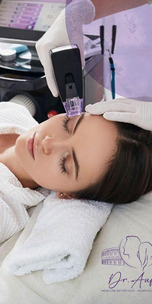 Morpheus 8 : un soin médical qui n’est pas seulement réservé aux peaux matures