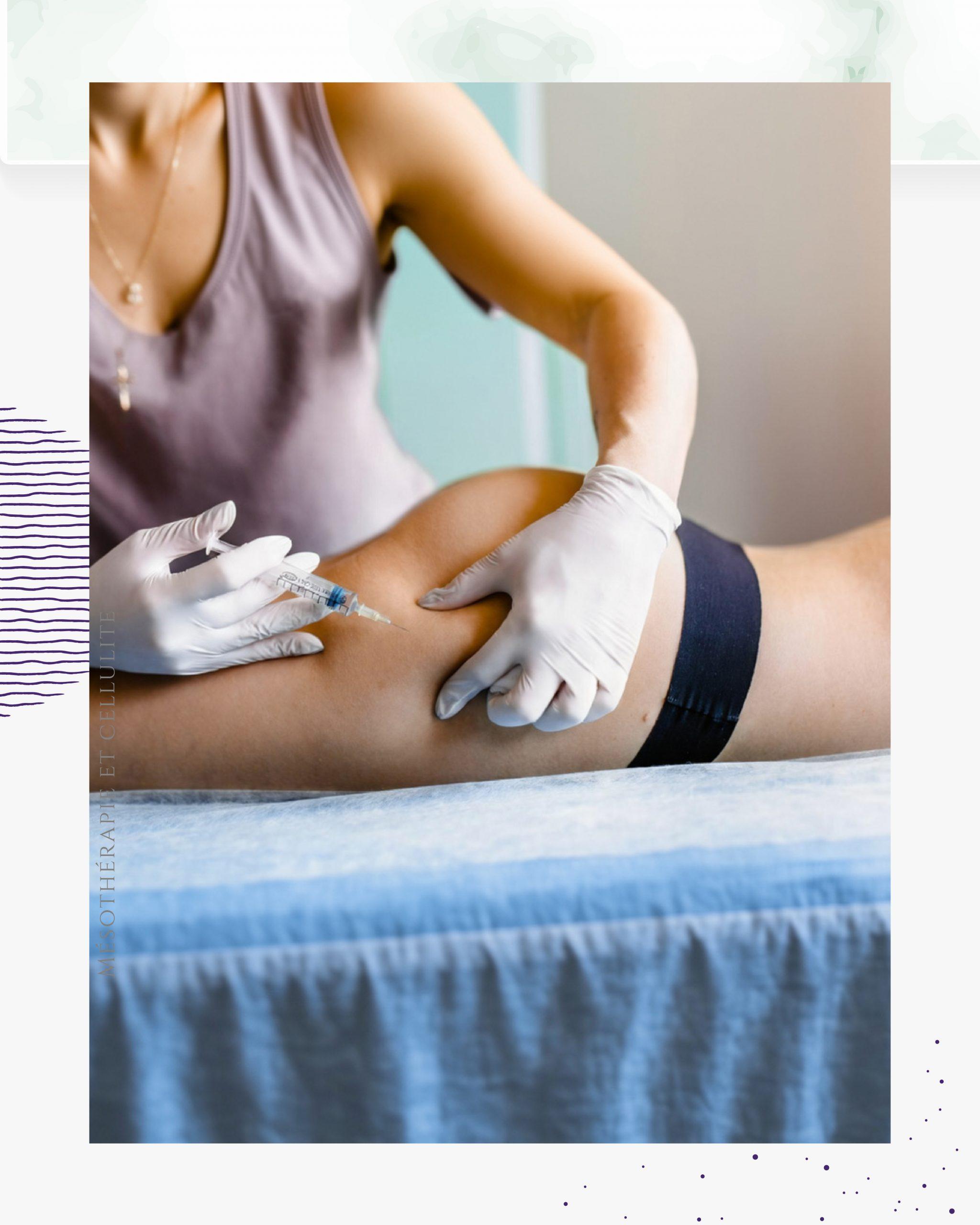 La prise en charge de la cellulite nécessite un protocole ciblé et une expertise technique. Grâce à la précision de la mésothérapie, nous agissons directement sur les causes physiologiques des capitons